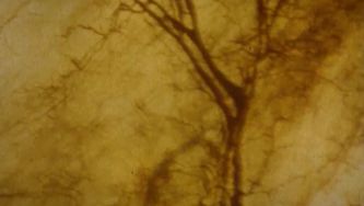 Vasos que transportam sangue 