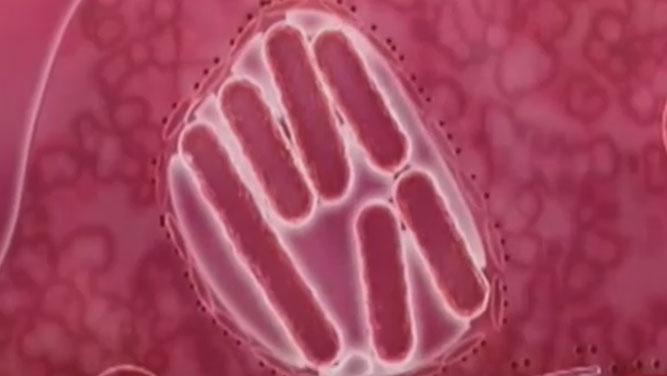 A Legionella é contraída por inalação