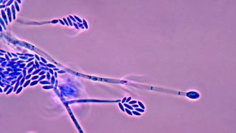 A descoberta da penicilina