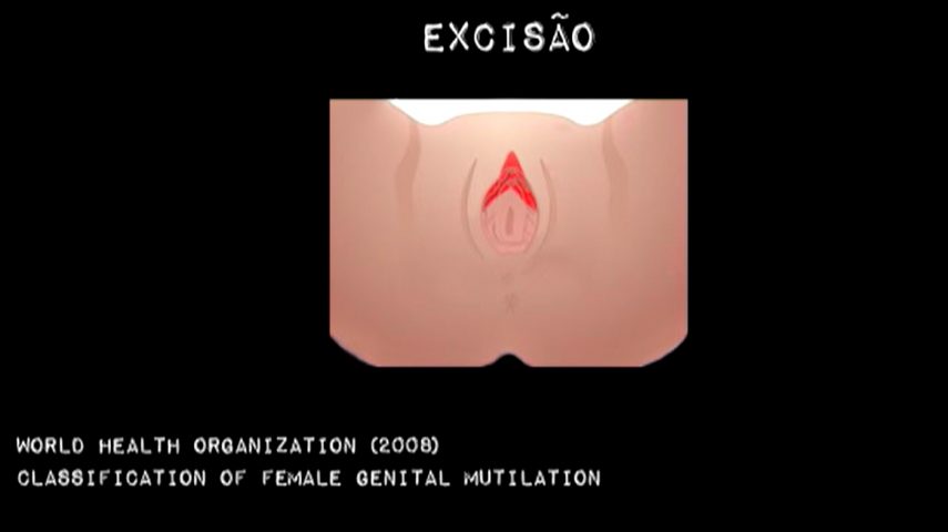 Mutilação genital feminina, um crime com várias formas