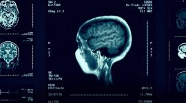 Imagem de As células do cérebro, um universo à parte