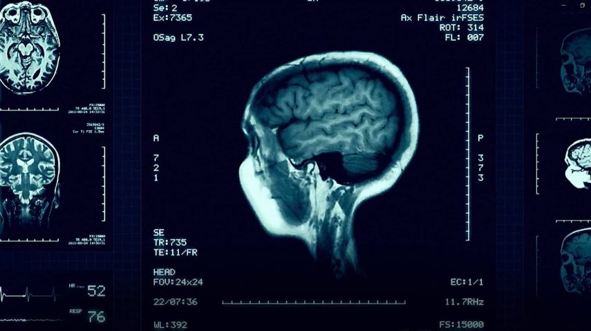 Imagem de As células do cérebro, um universo à parte